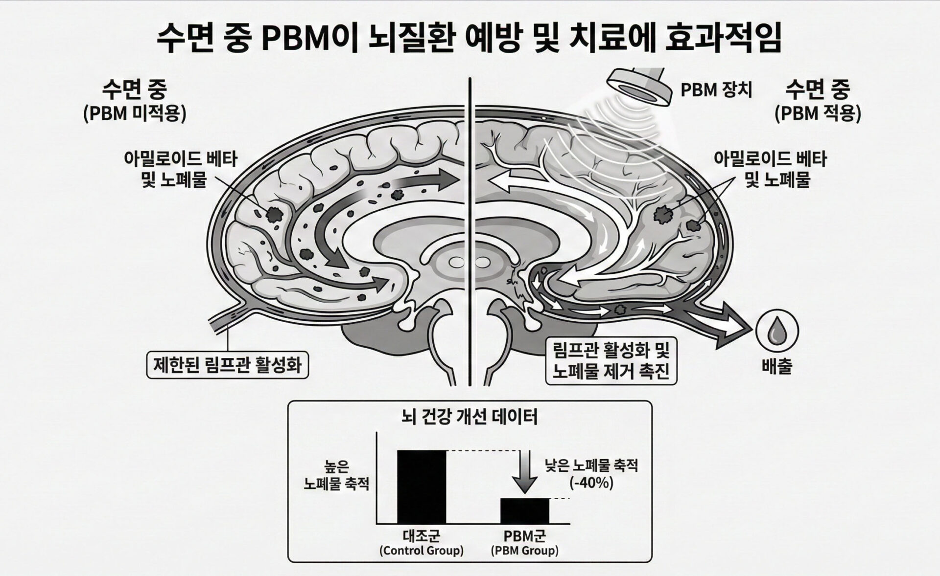 Brain_Waste_Removal_System_and_Sleep_Photobiomodulation_as_an_Innovative_Strategy