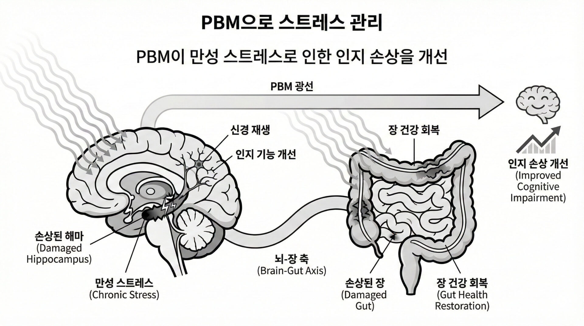 Brain–gut_photobiomodulation_restores_cognitive_alterations