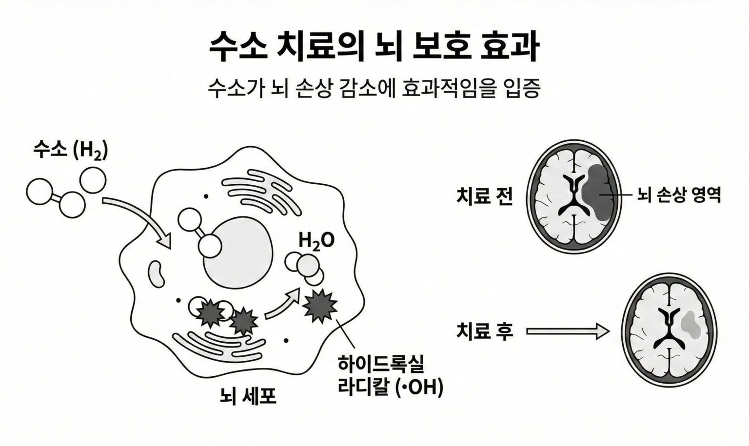 {"type":"elementor","siteurl":"https://hue-light.com/kr/wp-json/","elements":[{"id":"7f1dee64","elType":"widget","isInner":false,"isLocked":false,"settings":{"image":{"id":"12644","url":"https://hue-light.com/kr/wp-content/uploads/sites/5/2026/01/Hydrogen-acts-as-a-therapeutic-antioxidant-by-selectively-reducing-cytotoxic-oxygen-radicals.jpg","alt":"Hydrogen acts as a therapeutic antioxidant by selectively reducing cytotoxic oxygen radicals","source":"library","size":""},"_padding":{"unit":"px","top":"50","right":"0","bottom":"0","left":"0","isLinked":false},"_flex_align_self":"center","image_size":"large","image_custom_dimension":{"width":"","height":""},"caption_source":"none","caption":"","link_to":"none","link":{"url":"","is_external":"","nofollow":"","custom_attributes":""},"open_lightbox":"default","align":"","align_tablet":"","align_mobile":"","width":{"unit":"%","size":"","sizes":[]},"width_tablet":{"unit":"%","size":"","sizes":[]},"width_mobile":{"unit":"%","size":"","sizes":[]},"space":{"unit":"%","size":"","sizes":[]},"space_tablet":{"unit":"%","size":"","sizes":[]},"space_mobile":{"unit":"%","size":"","sizes":[]},"height":{"unit":"px","size":"","sizes":[]},"height_tablet":{"unit":"px","size":"","sizes":[]},"height_mobile":{"unit":"px","size":"","sizes":[]},"object-fit":"","object-fit_tablet":"","object-fit_mobile":"","object-position":"center center","object-position_tablet":"","object-position_mobile":"","opacity":{"unit":"px","size":"","sizes":[]},"css_filters_css_filter":"","css_filters_blur":{"unit":"px","size":0,"sizes":[]},"css_filters_brightness":{"unit":"px","size":100,"sizes":[]},"css_filters_contrast":{"unit":"px","size":100,"sizes":[]},"css_filters_saturate":{"unit":"px","size":100,"sizes":[]},"css_filters_hue":{"unit":"px","size":0,"sizes":[]},"opacity_hover":{"unit":"px","size":"","sizes":[]},"css_filters_hover_css_filter":"","css_filters_hover_blur":{"unit":"px","size":0,"sizes":[]},"css_filters_hover_brightness":{"unit":"px","size":100,"sizes":[]},"css_filters_hover_contrast":{"unit":"px","size":100,"sizes":[]},"css_filters_hover_saturate":{"unit":"px","size":100,"sizes":[]},"css_filters_hover_hue":{"unit":"px","size":0,"sizes":[]},"background_hover_transition":{"unit":"px","size":"","sizes":[]},"hover_animation":"","image_border_border":"","image_border_width":{"unit":"px","top":"","right":"","bottom":"","left":"","isLinked":true},"image_border_width_tablet":{"unit":"px","top":"","right":"","bottom":"","left":"","isLinked":true},"image_border_width_mobile":{"unit":"px","top":"","right":"","bottom":"","left":"","isLinked":true},"image_border_color":"","image_border_radius":{"unit":"px","top":"","right":"","bottom":"","left":"","isLinked":true},"image_border_radius_tablet":{"unit":"px","top":"","right":"","bottom":"","left":"","isLinked":true},"image_border_radius_mobile":{"unit":"px","top":"","right":"","bottom":"","left":"","isLinked":true},"image_box_shadow_box_shadow_type":"","image_box_shadow_box_shadow":{"horizontal":0,"vertical":0,"blur":10,"spread":0,"color":"rgba(0,0,0,0.5)"},"caption_align":"","caption_align_tablet":"","caption_align_mobile":"","text_color":"","caption_background_color":"","caption_typography_typography":"","caption_typography_font_family":"","caption_typography_font_size":{"unit":"px","size":"","sizes":[]},"caption_typography_font_size_tablet":{"unit":"px","size":"","sizes":[]},"caption_typography_font_size_mobile":{"unit":"px","size":"","sizes":[]},"caption_typography_font_weight":"","caption_typography_text_transform":"","caption_typography_font_style":"","caption_typography_text_decoration":"","caption_typography_line_height":{"unit":"px","size":"","sizes":[]},"caption_typography_line_height_tablet":{"unit":"em","size":"","sizes":[]},"caption_typography_line_height_mobile":{"unit":"em","size":"","sizes":[]},"caption_typography_letter_spacing":{"unit":"px","size":"","sizes":[]},"caption_typography_letter_spacing_tablet":{"unit":"px","size":"","sizes":[]},"caption_typography_letter_spacing_mobile":{"unit":"px","size":"","sizes":[]},"caption_typography_word_spacing":{"unit":"px","size":"","sizes":[]},"caption_typography_word_spacing_tablet":{"unit":"em","size":"","sizes":[]},"caption_typography_word_spacing_mobile":{"unit":"em","size":"","sizes":[]},"caption_text_shadow_text_shadow_type":"","caption_text_shadow_text_shadow":{"horizontal":0,"vertical":0,"blur":10,"color":"rgba(0,0,0,0.3)"},"caption_space":{"unit":"px","size":"","sizes":[]},"caption_space_tablet":{"unit":"px","size":"","sizes":[]},"caption_space_mobile":{"unit":"px","size":"","sizes":[]},"_title":"","_margin":{"unit":"px","top":"","right":"","bottom":"","left":"","isLinked":true},"_margin_tablet":{"unit":"px","top":"","right":"","bottom":"","left":"","isLinked":true},"_margin_mobile":{"unit":"px","top":"","right":"","bottom":"","left":"","isLinked":true},"_padding_tablet":{"unit":"px","top":"","right":"","bottom":"","left":"","isLinked":true},"_padding_mobile":{"unit":"px","top":"","right":"","bottom":"","left":"","isLinked":true},"_element_width":"","_element_width_tablet":"","_element_width_mobile":"","_element_custom_width":{"unit":"%","size":"","sizes":[]},"_element_custom_width_tablet":{"unit":"px","size":"","sizes":[]},"_element_custom_width_mobile":{"unit":"px","size":"","sizes":[]},"_grid_column":"","_grid_column_tablet":"","_grid_column_mobile":"","_grid_column_custom":"","_grid_column_custom_tablet":"","_grid_column_custom_mobile":"","_grid_row":"","_grid_row_tablet":"","_grid_row_mobile":"","_grid_row_custom":"","_grid_row_custom_tablet":"","_grid_row_custom_mobile":"","_flex_align_self_tablet":"","_flex_align_self_mobile":"","_flex_order":"","_flex_order_tablet":"","_flex_order_mobile":"","_flex_order_custom":"","_flex_order_custom_tablet":"","_flex_order_custom_mobile":"","_flex_size":"","_flex_size_tablet":"","_flex_size_mobile":"","_flex_grow":1,"_flex_grow_tablet":"","_flex_grow_mobile":"","_flex_shrink":1,"_flex_shrink_tablet":"","_flex_shrink_mobile":"","_element_vertical_align":"","_element_vertical_align_tablet":"","_element_vertical_align_mobile":"","_position":"","_offset_orientation_h":"start","_offset_x":{"unit":"px","size":0,"sizes":[]},"_offset_x_tablet":{"unit":"px","size":"","sizes":[]},"_offset_x_mobile":{"unit":"px","size":"","sizes":[]},"_offset_x_end":{"unit":"px","size":0,"sizes":[]},"_offset_x_end_tablet":{"unit":"px","size":"","sizes":[]},"_offset_x_end_mobile":{"unit":"px","size":"","sizes":[]},"_offset_orientation_v":"start","_offset_y":{"unit":"px","size":0,"sizes":[]},"_offset_y_tablet":{"unit":"px","size":"","sizes":[]},"_offset_y_mobile":{"unit":"px","size":"","sizes":[]},"_offset_y_end":{"unit":"px","size":0,"sizes":[]},"_offset_y_end_tablet":{"unit":"px","size":"","sizes":[]},"_offset_y_end_mobile":{"unit":"px","size":"","sizes":[]},"_z_index":"","_z_index_tablet":"","_z_index_mobile":"","_element_id":"","_css_classes":"","e_display_conditions":"","_element_cache":"","motion_fx_motion_fx_scrolling":"","motion_fx_translateY_effect":"","motion_fx_translateY_direction":"","motion_fx_translateY_speed":{"unit":"px","size":4,"sizes":[]},"motion_fx_translateY_affectedRange":{"unit":"%","size":"","sizes":{"start":0,"end":100}},"motion_fx_translateX_effect":"","motion_fx_translateX_direction":"","motion_fx_translateX_speed":{"unit":"px","size":4,"sizes":[]},"motion_fx_translateX_affectedRange":{"unit":"%","size":"","sizes":{"start":0,"end":100}},"motion_fx_opacity_effect":"","motion_fx_opacity_direction":"out-in","motion_fx_opacity_level":{"unit":"px","size":10,"sizes":[]},"motion_fx_opacity_range":{"unit":"%","size":"","sizes":{"start":20,"end":80}},"motion_fx_blur_effect":"","motion_fx_blur_direction":"out-in","motion_fx_blur_level":{"unit":"px","size":7,"sizes":[]},"motion_fx_blur_range":{"unit":"%","size":"","sizes":{"start":20,"end":80}},"motion_fx_rotateZ_effect":"","motion_fx_rotateZ_direction":"","motion_fx_rotateZ_speed":{"unit":"px","size":1,"sizes":[]},"motion_fx_rotateZ_affectedRange":{"unit":"%","size":"","sizes":{"start":0,"end":100}},"motion_fx_scale_effect":"","motion_fx_scale_direction":"out-in","motion_fx_scale_speed":{"unit":"px","size":4,"sizes":[]},"motion_fx_scale_range":{"unit":"%","size":"","sizes":{"start":20,"end":80}},"motion_fx_transform_origin_x":"center","motion_fx_transform_origin_y":"center","motion_fx_devices":["desktop","tablet","mobile"],"motion_fx_range":"","motion_fx_motion_fx_mouse":"","motion_fx_mouseTrack_effect":"","motion_fx_mouseTrack_direction":"","motion_fx_mouseTrack_speed":{"unit":"px","size":1,"sizes":[]},"motion_fx_tilt_effect":"","motion_fx_tilt_direction":"","motion_fx_tilt_speed":{"unit":"px","size":4,"sizes":[]},"handle_motion_fx_asset_loading":"","sticky":"","sticky_on":["desktop","tablet","mobile"],"sticky_offset":0,"sticky_offset_tablet":"","sticky_offset_mobile":"","sticky_effects_offset":0,"sticky_effects_offset_tablet":"","sticky_effects_offset_mobile":"","sticky_anchor_link_offset":0,"sticky_anchor_link_offset_tablet":"","sticky_anchor_link_offset_mobile":"","sticky_parent":"","_animation":"","_animation_tablet":"","_animation_mobile":"","animation_duration":"","_animation_delay":"","_transform_rotate_popover":"","_transform_rotateZ_effect":{"unit":"px","size":"","sizes":[]},"_transform_rotateZ_effect_tablet":{"unit":"deg","size":"","sizes":[]},"_transform_rotateZ_effect_mobile":{"unit":"deg","size":"","sizes":[]},"_transform_rotate_3d":"","_transform_rotateX_effect":{"unit":"px","size":"","sizes":[]},"_transform_rotateX_effect_tablet":{"unit":"deg","size":"","sizes":[]},"_transform_rotateX_effect_mobile":{"unit":"deg","size":"","sizes":[]},"_transform_rotateY_effect":{"unit":"px","size":"","sizes":[]},"_transform_rotateY_effect_tablet":{"unit":"deg","size":"","sizes":[]},"_transform_rotateY_effect_mobile":{"unit":"deg","size":"","sizes":[]},"_transform_perspective_effect":{"unit":"px","size":"","sizes":[]},"_transform_perspective_effect_tablet":{"unit":"px","size":"","sizes":[]},"_transform_perspective_effect_mobile":{"unit":"px","size":"","sizes":[]},"_transform_translate_popover":"","_transform_translateX_effect":{"unit":"px","size":"","sizes":[]},"_transform_translateX_effect_tablet":{"unit":"px","size":"","sizes":[]},"_transform_translateX_effect_mobile":{"unit":"px","size":"","sizes":[]},"_transform_translateY_effect":{"unit":"px","size":"","sizes":[]},"_transform_translateY_effect_tablet":{"unit":"px","size":"","sizes":[]},"_transform_translateY_effect_mobile":{"unit":"px","size":"","sizes":[]},"_transform_scale_popover":"","_transform_keep_proportions":"yes","_transform_scale_effect":{"unit":"px","size":"","sizes":[]},"_transform_scale_effect_tablet":{"unit":"px","size":"","sizes":[]},"_transform_scale_effect_mobile":{"unit":"px","size":"","sizes":[]},"_transform_scaleX_effect":{"unit":"px","size":"","sizes":[]},"_transform_scaleX_effect_tablet":{"unit":"px","size":"","sizes":[]},"_transform_scaleX_effect_mobile":{"unit":"px","size":"","sizes":[]},"_transform_scaleY_effect":{"unit":"px","size":"","sizes":[]},"_transform_scaleY_effect_tablet":{"unit":"px","size":"","sizes":[]},"_transform_scaleY_effect_mobile":{"unit":"px","size":"","sizes":[]},"_transform_skew_popover":"","_transform_skewX_effect":{"unit":"px","size":"","sizes":[]},"_transform_skewX_effect_tablet":{"unit":"deg","size":"","sizes":[]},"_transform_skewX_effect_mobile":{"unit":"deg","size":"","sizes":[]},"_transform_skewY_effect":{"unit":"px","size":"","sizes":[]},"_transform_skewY_effect_tablet":{"unit":"deg","size":"","sizes":[]},"_transform_skewY_effect_mobile":{"unit":"deg","size":"","sizes":[]},"_transform_flipX_effect":"","_transform_flipY_effect":"","_transform_rotate_popover_hover":"","_transform_rotateZ_effect_hover":{"unit":"px","size":"","sizes":[]},"_transform_rotateZ_effect_hover_tablet":{"unit":"deg","size":"","sizes":[]},"_transform_rotateZ_effect_hover_mobile":{"unit":"deg","size":"","sizes":[]},"_transform_rotate_3d_hover":"","_transform_rotateX_effect_hover":{"unit":"px","size":"","sizes":[]},"_transform_rotateX_effect_hover_tablet":{"unit":"deg","size":"","sizes":[]},"_transform_rotateX_effect_hover_mobile":{"unit":"deg","size":"","sizes":[]},"_transform_rotateY_effect_hover":{"unit":"px","size":"","sizes":[]},"_transform_rotateY_effect_hover_tablet":{"unit":"deg","size":"","sizes":[]},"_transform_rotateY_effect_hover_mobile":{"unit":"deg","size":"","sizes":[]},"_transform_perspective_effect_hover":{"unit":"px","size":"","sizes":[]},"_transform_perspective_effect_hover_tablet":{"unit":"px","size":"","sizes":[]},"_transform_perspective_effect_hover_mobile":{"unit":"px","size":"","sizes":[]},"_transform_translate_popover_hover":"","_transform_translateX_effect_hover":{"unit":"px","size":"","sizes":[]},"_transform_translateX_effect_hover_tablet":{"unit":"px","size":"","sizes":[]},"_transform_translateX_effect_hover_mobile":{"unit":"px","size":"","sizes":[]},"_transform_translateY_effect_hover":{"unit":"px","size":"","sizes":[]},"_transform_translateY_effect_hover_tablet":{"unit":"px","size":"","sizes":[]},"_transform_translateY_effect_hover_mobile":{"unit":"px","size":"","sizes":[]},"_transform_scale_popover_hover":"","_transform_keep_proportions_hover":"yes","_transform_scale_effect_hover":{"unit":"px","size":"","sizes":[]},"_transform_scale_effect_hover_tablet":{"unit":"px","size":"","sizes":[]},"_transform_scale_effect_hover_mobile":{"unit":"px","size":"","sizes":[]},"_transform_scaleX_effect_hover":{"unit":"px","size":"","sizes":[]},"_transform_scaleX_effect_hover_tablet":{"unit":"px","size":"","sizes":[]},"_transform_scaleX_effect_hover_mobile":{"unit":"px","size":"","sizes":[]},"_transform_scaleY_effect_hover":{"unit":"px","size":"","sizes":[]},"_transform_scaleY_effect_hover_tablet":{"unit":"px","size":"","sizes":[]},"_transform_scaleY_effect_hover_mobile":{"unit":"px","size":"","sizes":[]},"_transform_skew_popover_hover":"","_transform_skewX_effect_hover":{"unit":"px","size":"","sizes":[]},"_transform_skewX_effect_hover_tablet":{"unit":"deg","size":"","sizes":[]},"_transform_skewX_effect_hover_mobile":{"unit":"deg","size":"","sizes":[]},"_transform_skewY_effect_hover":{"unit":"px","size":"","sizes":[]},"_transform_skewY_effect_hover_tablet":{"unit":"deg","size":"","sizes":[]},"_transform_skewY_effect_hover_mobile":{"unit":"deg","size":"","sizes":[]},"_transform_flipX_effect_hover":"","_transform_flipY_effect_hover":"","_transform_transition_hover":{"unit":"px","size":"","sizes":[]},"motion_fx_transform_x_anchor_point":"","motion_fx_transform_x_anchor_point_tablet":"","motion_fx_transform_x_anchor_point_mobile":"","motion_fx_transform_y_anchor_point":"","motion_fx_transform_y_anchor_point_tablet":"","motion_fx_transform_y_anchor_point_mobile":"","_background_background":"","_background_color":"","_background_color_stop":{"unit":"%","size":0,"sizes":[]},"_background_color_stop_tablet":{"unit":"%"},"_background_color_stop_mobile":{"unit":"%"},"_background_color_b":"#f2295b","_background_color_b_stop":{"unit":"%","size":100,"sizes":[]},"_background_color_b_stop_tablet":{"unit":"%"},"_background_color_b_stop_mobile":{"unit":"%"},"_background_gradient_type":"linear","_background_gradient_angle":{"unit":"deg","size":180,"sizes":[]},"_background_gradient_angle_tablet":{"unit":"deg"},"_background_gradient_angle_mobile":{"unit":"deg"},"_background_gradient_position":"center center","_background_gradient_position_tablet":"","_background_gradient_position_mobile":"","_background_image":{"url":"","id":"","size":""},"_background_image_tablet":{"url":"","id":"","size":""},"_background_image_mobile":{"url":"","id":"","size":""},"_background_position":"","_background_position_tablet":"","_background_position_mobile":"","_background_xpos":{"unit":"px","size":0,"sizes":[]},"_background_xpos_tablet":{"unit":"px","size":0,"sizes":[]},"_background_xpos_mobile":{"unit":"px","size":0,"sizes":[]},"_background_ypos":{"unit":"px","size":0,"sizes":[]},"_background_ypos_tablet":{"unit":"px","size":0,"sizes":[]},"_background_ypos_mobile":{"unit":"px","size":0,"sizes":[]},"_background_attachment":"","_background_repeat":"","_background_repeat_tablet":"","_background_repeat_mobile":"","_background_size":"","_background_size_tablet":"","_background_size_mobile":"","_background_bg_width":{"unit":"%","size":100,"sizes":[]},"_background_bg_width_tablet":{"unit":"px","size":"","sizes":[]},"_background_bg_width_mobile":{"unit":"px","size":"","sizes":[]},"_background_video_link":"","_background_video_start":"","_background_video_end":"","_background_play_once":"","_background_play_on_mobile":"","_background_privacy_mode":"","_background_video_fallback":{"url":"","id":"","size":""},"_background_slideshow_gallery":[],"_background_slideshow_loop":"yes","_background_slideshow_slide_duration":5000,"_background_slideshow_slide_transition":"fade","_background_slideshow_transition_duration":500,"_background_slideshow_background_size":"","_background_slideshow_background_size_tablet":"","_background_slideshow_background_size_mobile":"","_background_slideshow_background_position":"","_background_slideshow_background_position_tablet":"","_background_slideshow_background_position_mobile":"","_background_slideshow_lazyload":"","_background_slideshow_ken_burns":"","_background_slideshow_ken_burns_zoom_direction":"in","_background_hover_background":"","_background_hover_color":"","_background_hover_color_stop":{"unit":"%","size":0,"sizes":[]},"_background_hover_color_stop_tablet":{"unit":"%"},"_background_hover_color_stop_mobile":{"unit":"%"},"_background_hover_color_b":"#f2295b","_background_hover_color_b_stop":{"unit":"%","size":100,"sizes":[]},"_background_hover_color_b_stop_tablet":{"unit":"%"},"_background_hover_color_b_stop_mobile":{"unit":"%"},"_background_hover_gradient_type":"linear","_background_hover_gradient_angle":{"unit":"deg","size":180,"sizes":[]},"_background_hover_gradient_angle_tablet":{"unit":"deg"},"_background_hover_gradient_angle_mobile":{"unit":"deg"},"_background_hover_gradient_position":"center center","_background_hover_gradient_position_tablet":"","_background_hover_gradient_position_mobile":"","_background_hover_image":{"url":"","id":"","size":""},"_background_hover_image_tablet":{"url":"","id":"","size":""},"_background_hover_image_mobile":{"url":"","id":"","size":""},"_background_hover_position":"","_background_hover_position_tablet":"","_background_hover_position_mobile":"","_background_hover_xpos":{"unit":"px","size":0,"sizes":[]},"_background_hover_xpos_tablet":{"unit":"px","size":0,"sizes":[]},"_background_hover_xpos_mobile":{"unit":"px","size":0,"sizes":[]},"_background_hover_ypos":{"unit":"px","size":0,"sizes":[]},"_background_hover_ypos_tablet":{"unit":"px","size":0,"sizes":[]},"_background_hover_ypos_mobile":{"unit":"px","size":0,"sizes":[]},"_background_hover_attachment":"","_background_hover_repeat":"","_background_hover_repeat_tablet":"","_background_hover_repeat_mobile":"","_background_hover_size":"","_background_hover_size_tablet":"","_background_hover_size_mobile":"","_background_hover_bg_width":{"unit":"%","size":100,"sizes":[]},"_background_hover_bg_width_tablet":{"unit":"px","size":"","sizes":[]},"_background_hover_bg_width_mobile":{"unit":"px","size":"","sizes":[]},"_background_hover_video_link":"","_background_hover_video_start":"","_background_hover_video_end":"","_background_hover_play_once":"","_background_hover_play_on_mobile":"","_background_hover_privacy_mode":"","_background_hover_video_fallback":{"url":"","id":"","size":""},"_background_hover_slideshow_gallery":[],"_background_hover_slideshow_loop":"yes","_background_hover_slideshow_slide_duration":5000,"_background_hover_slideshow_slide_transition":"fade","_background_hover_slideshow_transition_duration":500,"_background_hover_slideshow_background_size":"","_background_hover_slideshow_background_size_tablet":"","_background_hover_slideshow_background_size_mobile":"","_background_hover_slideshow_background_position":"","_background_hover_slideshow_background_position_tablet":"","_background_hover_slideshow_background_position_mobile":"","_background_hover_slideshow_lazyload":"","_background_hover_slideshow_ken_burns":"","_background_hover_slideshow_ken_burns_zoom_direction":"in","_background_hover_transition":{"unit":"px","size":"","sizes":[]},"_border_border":"","_border_width":{"unit":"px","top":"","right":"","bottom":"","left":"","isLinked":true},"_border_width_tablet":{"unit":"px","top":"","right":"","bottom":"","left":"","isLinked":true},"_border_width_mobile":{"unit":"px","top":"","right":"","bottom":"","left":"","isLinked":true},"_border_color":"","_border_radius":{"unit":"px","top":"","right":"","bottom":"","left":"","isLinked":true},"_border_radius_tablet":{"unit":"px","top":"","right":"","bottom":"","left":"","isLinked":true},"_border_radius_mobile":{"unit":"px","top":"","right":"","bottom":"","left":"","isLinked":true},"_box_shadow_box_shadow_type":"","_box_shadow_box_shadow":{"horizontal":0,"vertical":0,"blur":10,"spread":0,"color":"rgba(0,0,0,0.5)"},"_box_shadow_box_shadow_position":" ","_border_hover_border":"","_border_hover_width":{"unit":"px","top":"","right":"","bottom":"","left":"","isLinked":true},"_border_hover_width_tablet":{"unit":"px","top":"","right":"","bottom":"","left":"","isLinked":true},"_border_hover_width_mobile":{"unit":"px","top":"","right":"","bottom":"","left":"","isLinked":true},"_border_hover_color":"","_border_radius_hover":{"unit":"px","top":"","right":"","bottom":"","left":"","isLinked":true},"_border_radius_hover_tablet":{"unit":"px","top":"","right":"","bottom":"","left":"","isLinked":true},"_border_radius_hover_mobile":{"unit":"px","top":"","right":"","bottom":"","left":"","isLinked":true},"_box_shadow_hover_box_shadow_type":"","_box_shadow_hover_box_shadow":{"horizontal":0,"vertical":0,"blur":10,"spread":0,"color":"rgba(0,0,0,0.5)"},"_box_shadow_hover_box_shadow_position":" ","_border_hover_transition":{"unit":"px","size":"","sizes":[]},"_mask_switch":"","_mask_shape":"circle","_mask_image":{"url":"","id":"","size":""},"_mask_image_tablet":{"url":"","id":"","size":""},"_mask_image_mobile":{"url":"","id":"","size":""},"_mask_size":"contain","_mask_size_tablet":"","_mask_size_mobile":"","_mask_size_scale":{"unit":"%","size":100,"sizes":[]},"_mask_size_scale_tablet":{"unit":"px","size":"","sizes":[]},"_mask_size_scale_mobile":{"unit":"px","size":"","sizes":[]},"_mask_position":"center center","_mask_position_tablet":"","_mask_position_mobile":"","_mask_position_x":{"unit":"%","size":0,"sizes":[]},"_mask_position_x_tablet":{"unit":"px","size":"","sizes":[]},"_mask_position_x_mobile":{"unit":"px","size":"","sizes":[]},"_mask_position_y":{"unit":"%","size":0,"sizes":[]},"_mask_position_y_tablet":{"unit":"px","size":"","sizes":[]},"_mask_position_y_mobile":{"unit":"px","size":"","sizes":[]},"_mask_repeat":"no-repeat","_mask_repeat_tablet":"","_mask_repeat_mobile":"","hide_desktop":"","hide_tablet":"","hide_mobile":"","_attributes":"","custom_css":""},"defaultEditSettings":{"defaultEditRoute":"content"},"elements":[],"widgetType":"image","htmlCache":"\t\t\n\t\t\t\t\t\t\t\t\t\t\t\t\t\t\t\t\t\t\t\t\t\t\t\t\t\t\t\t\t\t\n\t\t","editSettings":{"defaultEditRoute":"content","panel":{"activeTab":"content","activeSection":"section_image"}}}]}