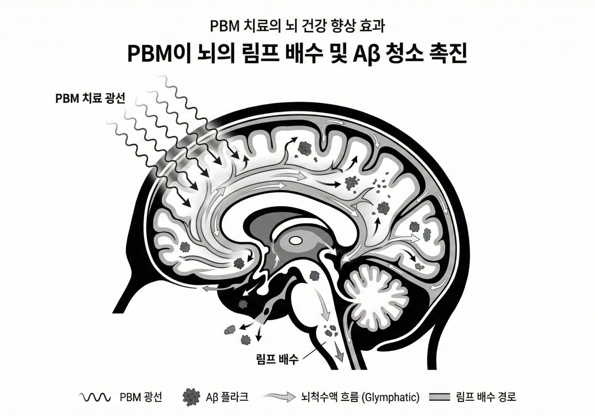 Photobiomodulation_Therapy_and_the_Glymphatic_System_Prom_sing_Applications