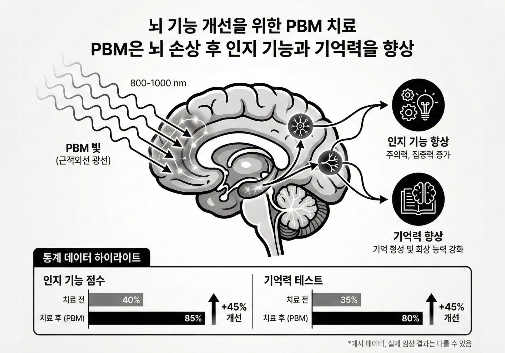 Photobiomodulation_for_Traumatic_Brain_Injury_and_Stroke