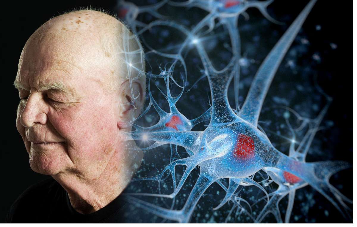 Cooking Oil and Neurodegenerative Diseases