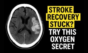 Hyperbaric Oxygen Therapy for Stroke Patients