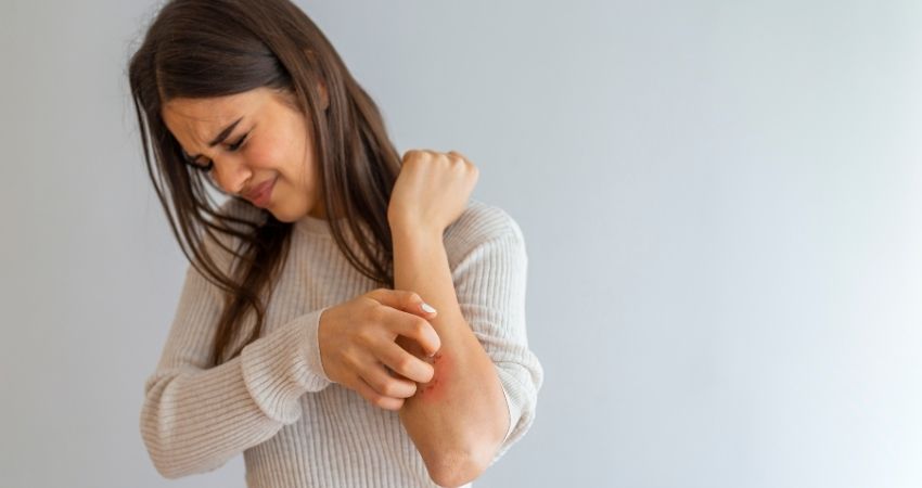 psoriasis