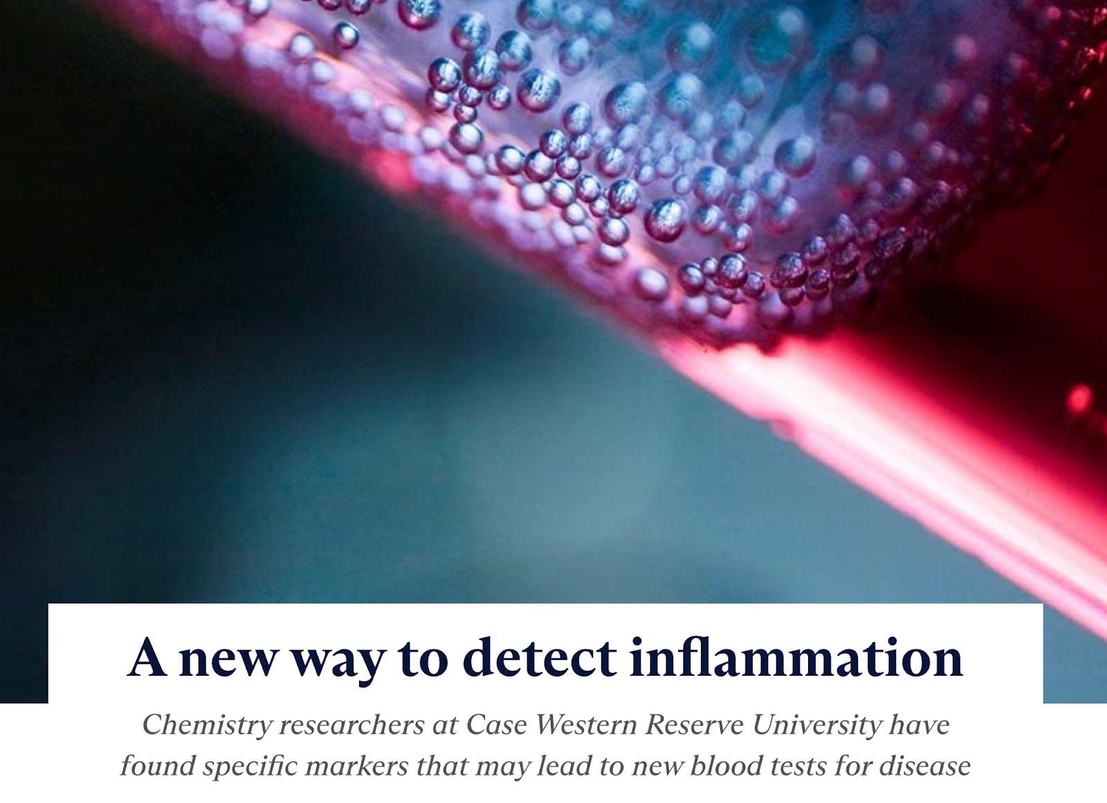 Pinpointing the Exact Location of Inflammation