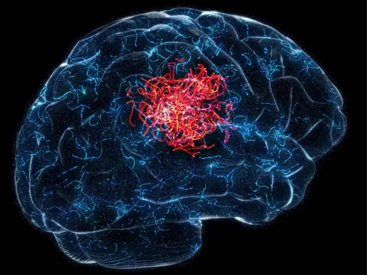 Molecular Hydrogen Protects the Brain