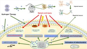 hydrogen inhalation therapy selective antioxidant mechanism