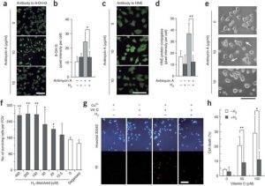 From Selective Antioxidation to Neuroprotection: The Clinical Science of Hydrogen Inhalation Therapy
