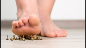 chemotherapy-induced peripheral neuropathy after oxaliplatin